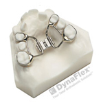 A dental model showcasing an orthodontic appliance on a replica of upper teeth, featuring metal bands and an expansion screw for adjusting alignment.
